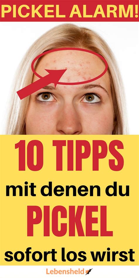 pickel entfernen tips.